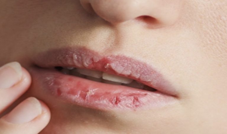 چطور از شر خشکی و ترک لب ها بعد از استفاده از رژهای ۲۴ ساعته خلاص بشیم…
